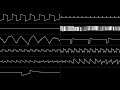 VinylCheese - "The Street Loader" (FC + N163) [Oscilloscope View]