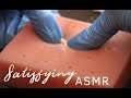Satisfying Pimple Popping ASMR Video