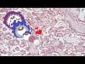 Placenta, pupočník (chorion, decidua basalis) Histológia - pohlavný systém