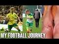 How I Became a Professional Footballer - Two ACL Injuries, Getting Released (My Football Journey)