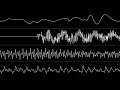 XTD - “In a Blaze” (Amiga MOD) [Oscilloscope View]