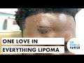 One Love in Everything... Lipoma