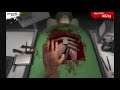 Let's Murder Surgery Patient Part 2 Surgeon Simulator 2013 Gameplay Let's Play WTF GOTY Edition