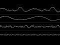 XTD - “All The Way” (Amiga MOD) [Oscilloscope View]
