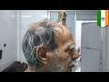 Four-inch 'devil horn' removed from Indian man's head - TomoNews