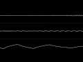 Glenn Rune Gallefoss - "L-Forza Remix" (C64) [Oscilloscope View]
