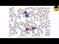 How Bacteria's Can Be Killed? Part - 29 Shigella