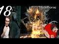 Final DLC Boss : Bloodborne CO OP Playthrough with DeadlyDax EP 18