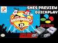 Animaniacs (SNES) PREVIEW/QUICKPLAY NO COMMENTARY HD 1080p