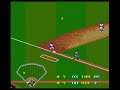 HDTL Episode 128: Cal Ripken Jr. Baseball | UNHITTABLE 50 MPH PITCHES