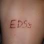 EDSs