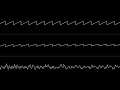 LMan - “Vortex” (C64) [Improved Oscilloscope View]