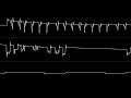 Vincenzo - “FreeFall” (C64) [Oscilloscope View]