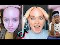 Funniest BAD Hairline Check Tik Toks
