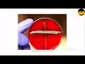 How Bacteria's Can Be Killed? Part - 12 Streptococcus Agalactiae