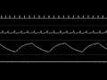 Neil Baldwin - “Dropzone (NES) - Title Theme” NTSC & PAL [Oscilloscope View]