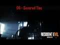 Resident Evil VII 06 - Severed Ties