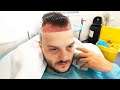 TGF DO IT #6 - Hairline Surgery Edition