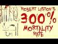 Robert Liston's 300% Mortality Rate