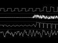 Rob Hubbard - “Kings of the Beach (C64) - Intro” [Oscilloscope View]