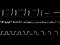 Zeinok - “FamiCommodore” (C64) [Oscilloscope View]