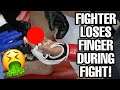 MMA FIGHTER LOSES HIS FINGER DURING FIGHT!!! CFFC 94 KHETAG PLIEV INJURY NEWS