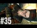 Skyrim Legendary (Max) Difficulty Part 35 - Infinite Jest