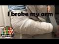 I broke my arm - Future videos