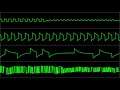 Grzegorz Kwiatek (Greg) - "New Wave" [Atari 8-bit] (Chiptune Visualization)