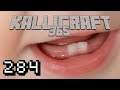 Hallo, i han 2 Zähne - KalliCraft 365 #284