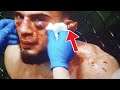 UFC FIGHTERS EAR RIPPED OFF DURING UFC FIGHT - UFC VEGAS 13 NEWS - BRAHIMAJ VS GRIFFIN