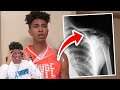 ALL OF MY WORST BASKETBALL INJURIES! *STORYTIME*