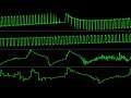 Tomasz Liebich - "Ucieczka" [Atari 8-bit] (Chiptune Visualization)