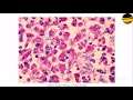 How Bacteria's Can Be Killed? Part - 43 Physeo Pollution