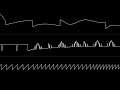 Glenn Rune Gallefoss - "Disco Robotski" (C64) [Oscilloscope View]