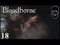 Press R1 & Win || Bloodborne Part 18