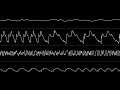 Estrayk - “Hedgehog” (Amiga MOD) [Oscilloscope View]