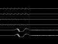 William Henley - “Fearless” [Oscilloscope View]