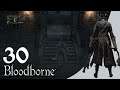 Bloodborne Part 30 Amygdala And Back To The Mensis!!