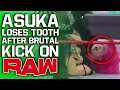 Asuka Loses Tooth After Brutal Kick On WWE Raw | Top NXT Star Switching Brands