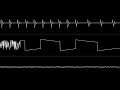 Fanta - “2Kunden+2K=E2E4K” (C64) [Oscilloscope View]