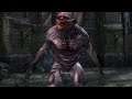 The Witcher : Enhanced Edition Walkthrough #41 Following The Thread