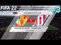 FIFA 22 - Manchester United vs. Stoke City - The Emirates FA CUP | FIFA 22 Gameplay
