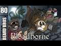 Bloodborne The Worst Area | Ep. #80 | Super Beard Bros