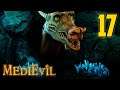 Nate's Privilege Is Showing and I Must Touch It - MediEvil : Part 17