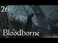 Zagrajmy w Bloodborne [#26] - BOSS w ZAKAZANYM LESIE