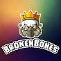 BrokenBones