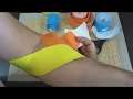Painful Supination of Wrist Outward Forearm Rotation Kinesio Tape Northern Soul channel