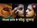 7 दिनों में जड़ से खत्म करें मुँहासे | How To Remove Pimples In Just 7 Days | Beauty Tips In Hindi