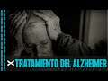 Novedoso tratamiento para el ALZHEIMER - Dr. Guido Dormán